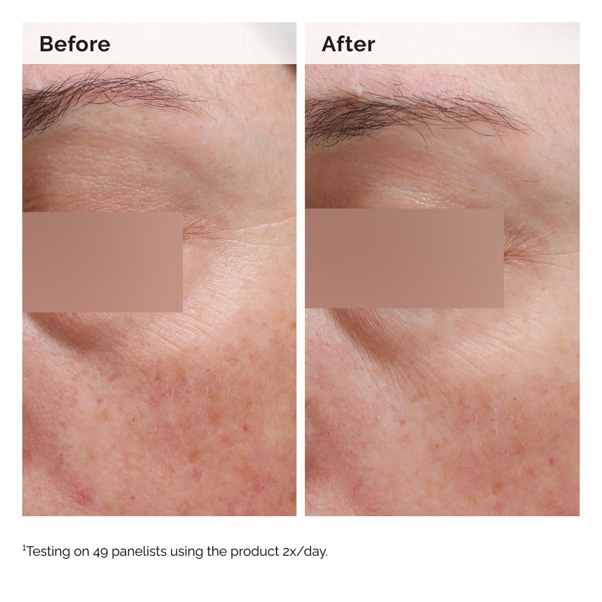 niacinamide-5-face-and-body-emulsion-l3 2024-08-23-ORD-Nia-5pct-Face-Body-B-A-Elasticity-Global-02-1x1.jpg