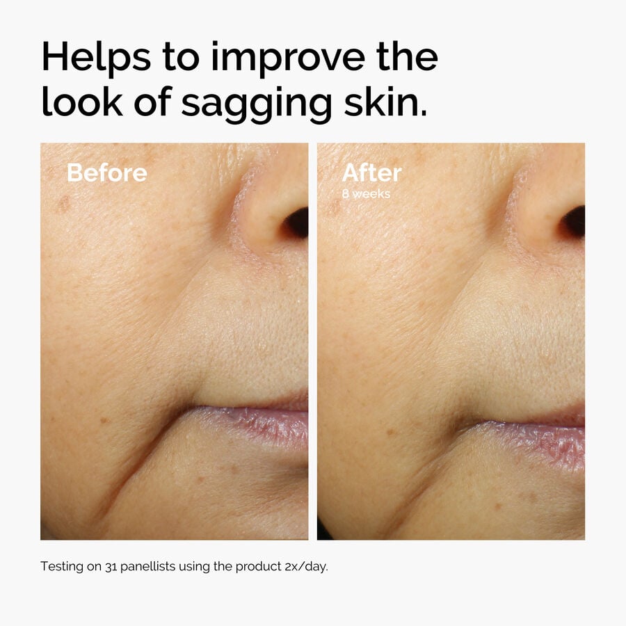 caffeine-3-escin-1-face-serum-z6 ord-caffeine-3pct-escin-1pct-face-serum-before-after-sagging.jpg