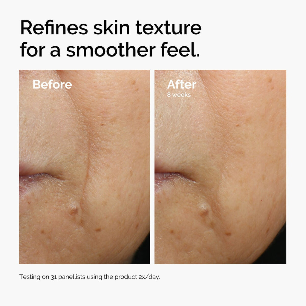 caffeine-3-escin-1-face-serum-z6 ord-caffeine-3pct-escin-1pct-face-serum-before-after-texture.jpg