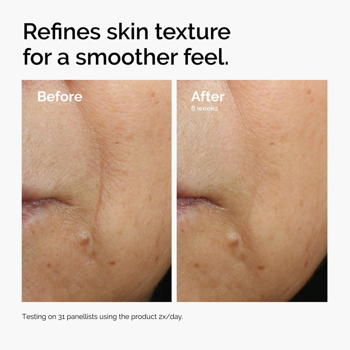 caffeine-3-escin-1-face-serum-z6 ord-caffeine-3pct-escin-1pct-face-serum-before-after-texture.jpg