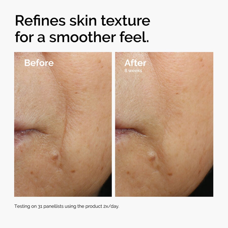 caffeine-3-escin-1-face-serum-z6 ord-caffeine-3pct-escin-1pct-face-serum-before-after-texture.jpg
