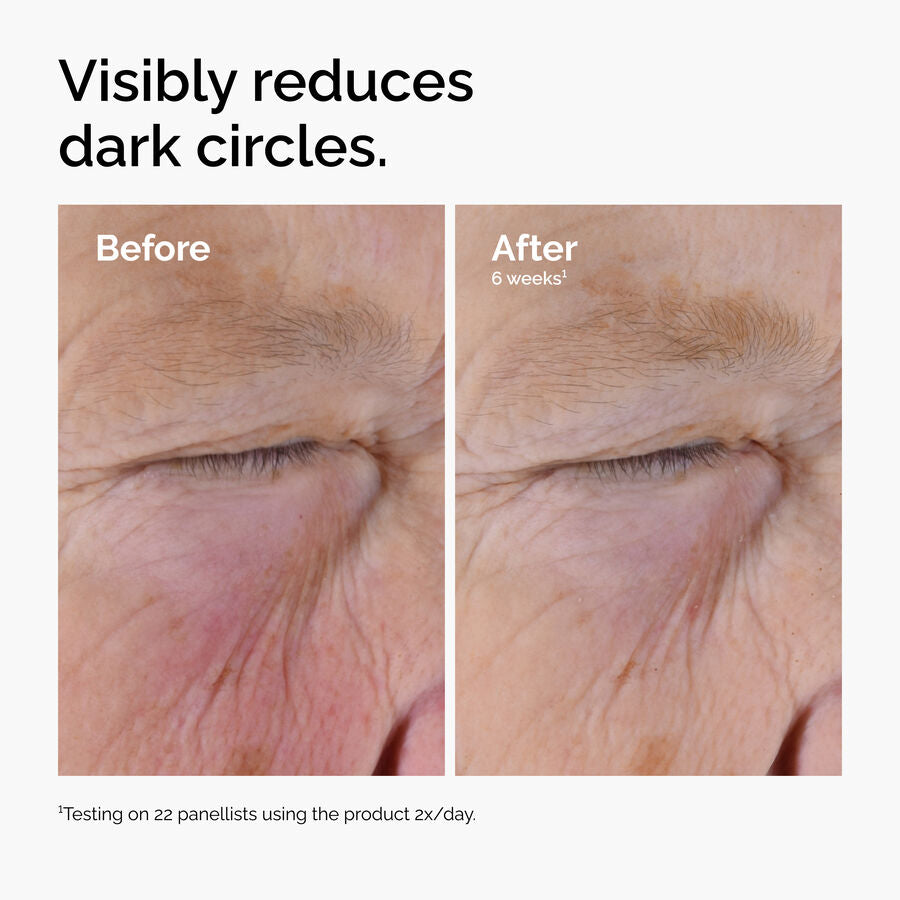 caffeine-solution-5-egcg-eye-serum-y5 ord-caffeine-solution-egcg-dark-circles-before-after.jpg