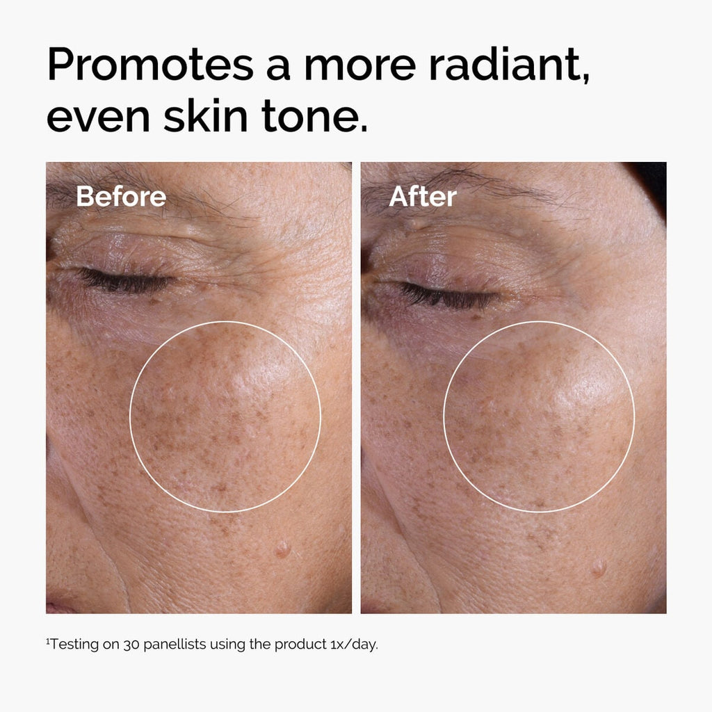 glycolic-acid-7-exfoliating-toner-n3 ord-glycolic-before-after-radiance.jpg
