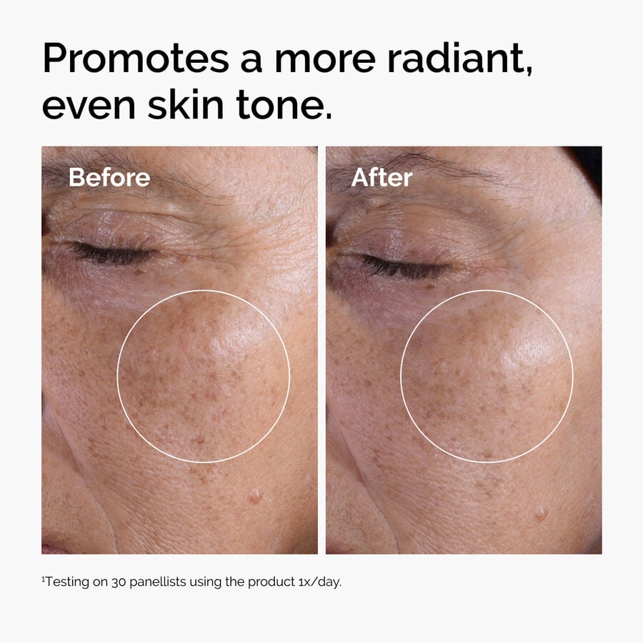 glycolic-acid-7-exfoliating-toner-n3 ord-glycolic-before-after-radiance.jpg