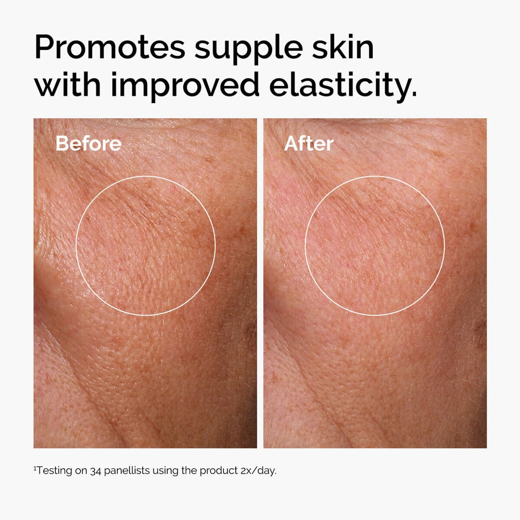 hyaluronic-acid-2-b5-with-ceramides-l9 ord-hyaluronic-acid-2pct-b5-hydrating-serum-before-after-elasticity.jpg