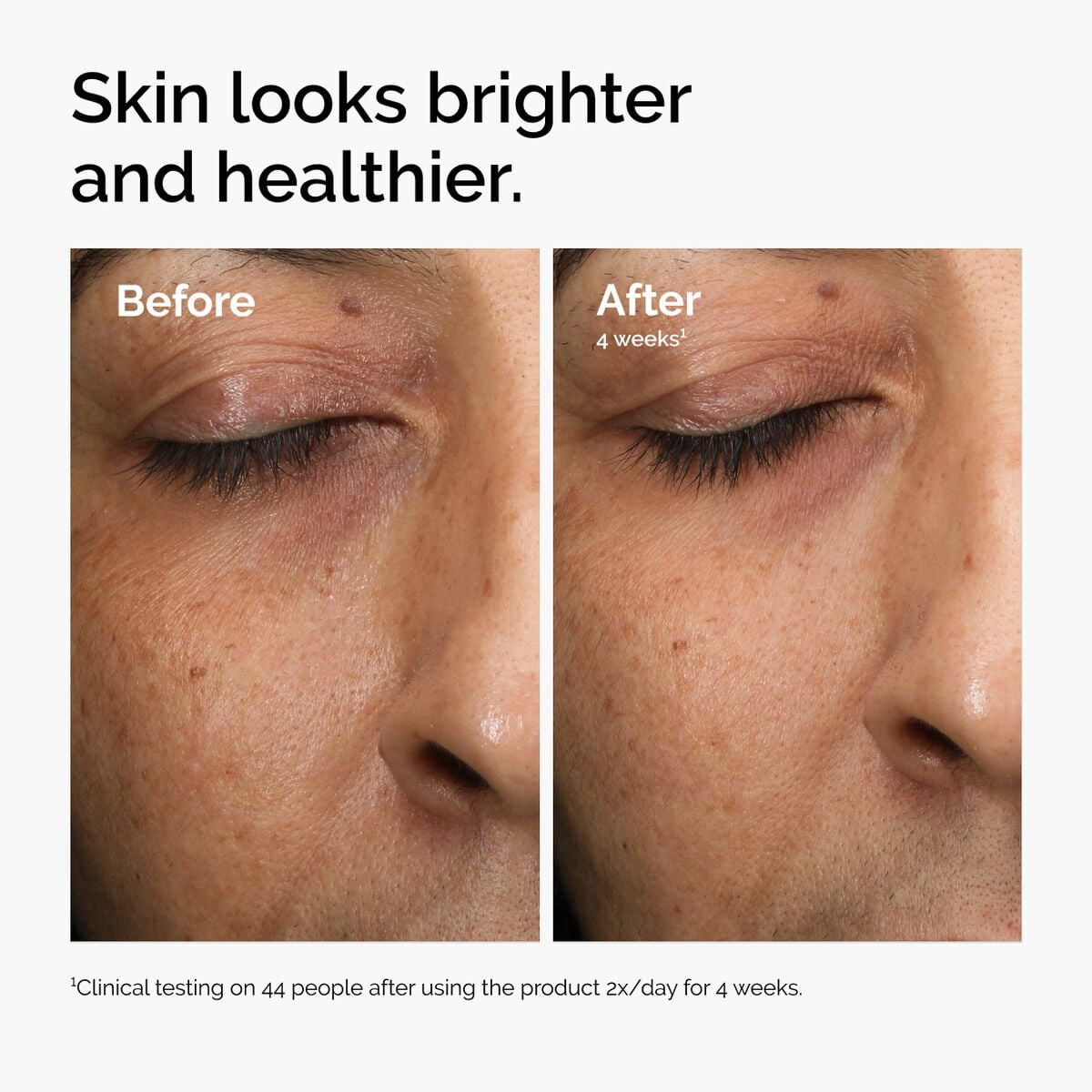 multi-antioxidant-radiance-serum-m6 ord-mars-before-after-healthy.jpg