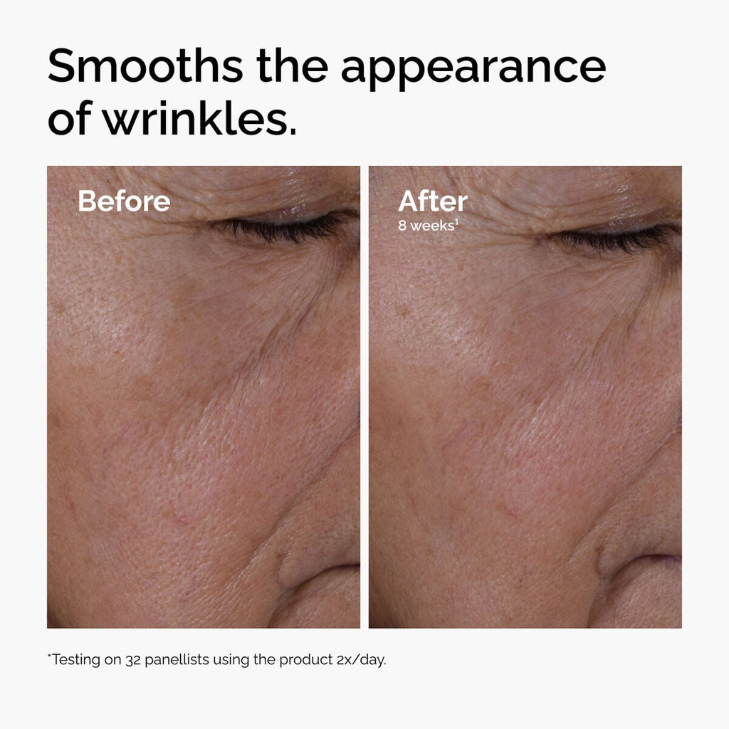 multi-peptide-ha-serum-q3 ord-multi-peptide-ha-serum-wrinkles-before-after.jpg