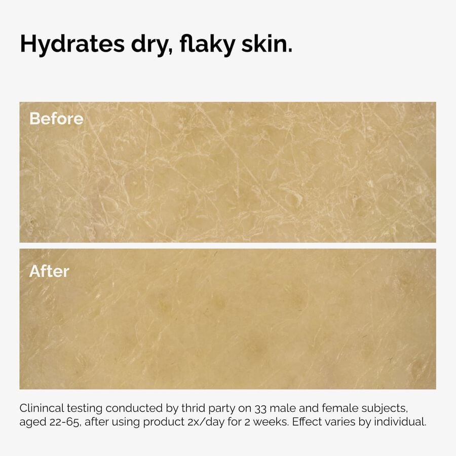 the-body-care-collection-x9 ord-natural-moisturizing-factors-inulin-body-before-after-graphic-02.jpg