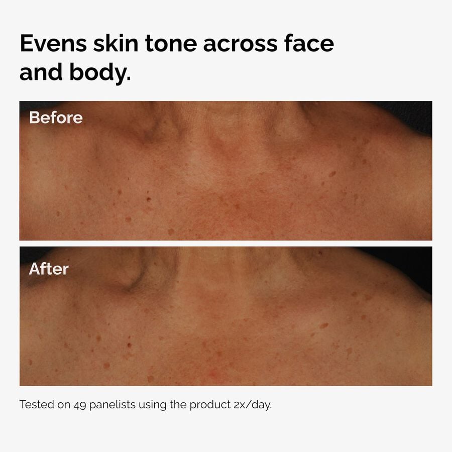 the-body-care-collection-x9 ord-niacinamide-face-body-serum-before-after-even-tone-graphic.jpg