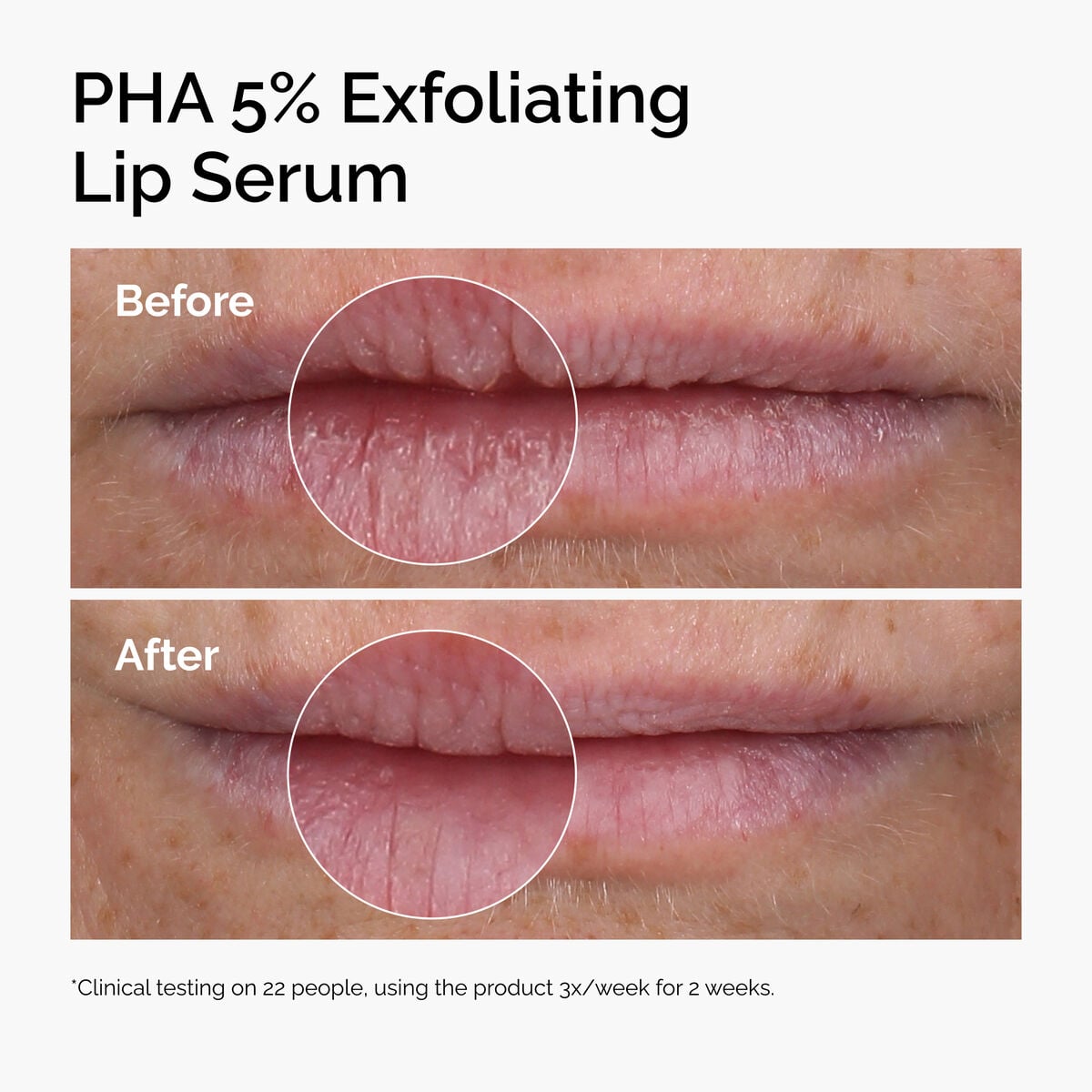pha-5-exfoliating-lip-serum-x6 ord-pha-5pct-lip-exfoliating-serum-before-after.jpg