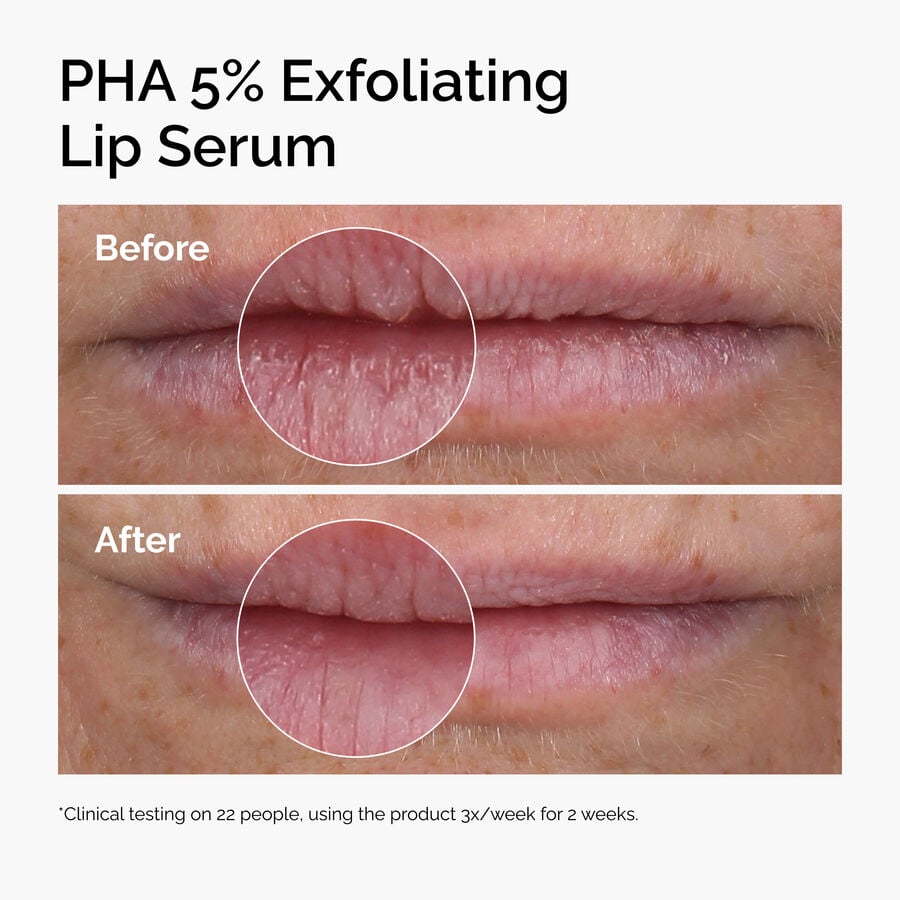 pha-5-exfoliating-lip-serum-b3 ord-pha-5pct-lip-exfoliating-serum-before-after.jpg